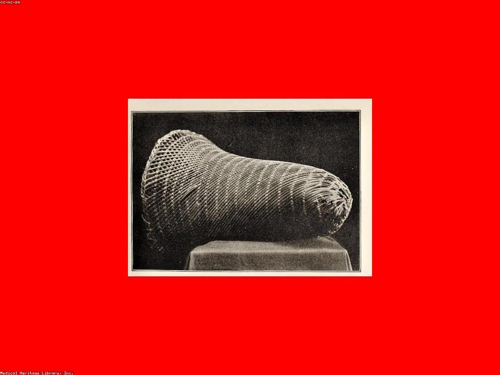 ហេតុអ្វីបានជាឈ្នះក្នុងវប្បធម៌